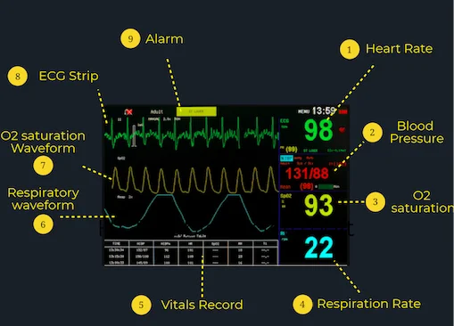 patient-monitor